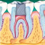 Endodontia conclida
